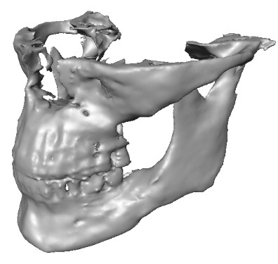 Beispiel eines digitalen anatomischen 3D-Modells